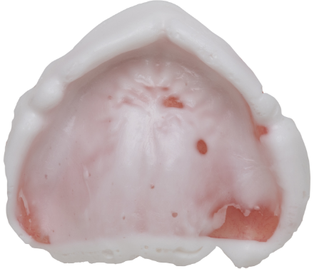 フィットチェッカーⅡ