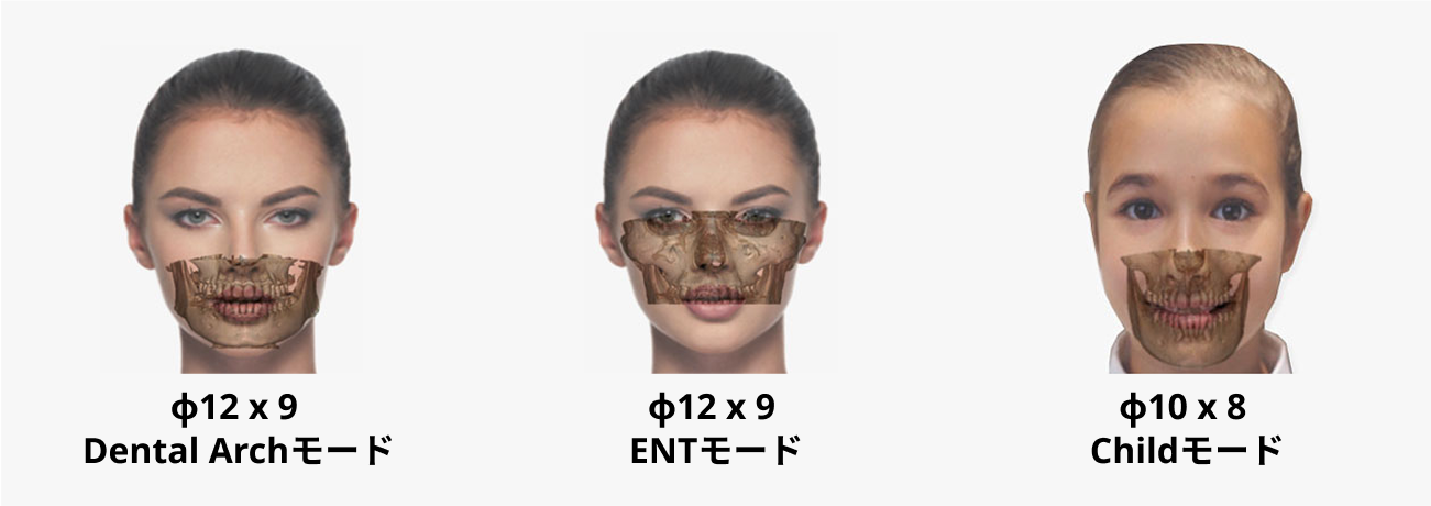 FOVモードの画像