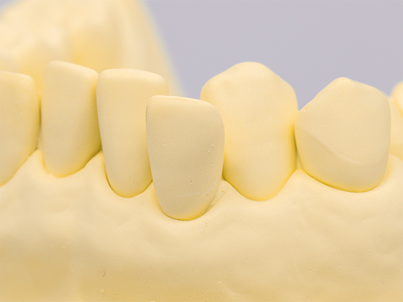 ユーデントユーデントストーン