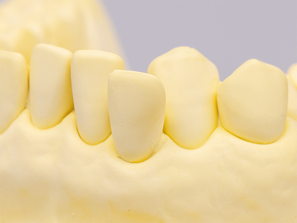 睦化学工業ネオプラムストーン