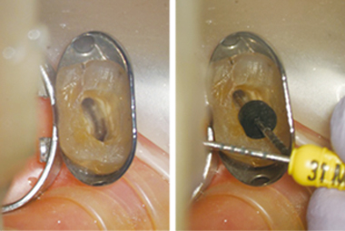 マイクロスコープとの併用も可能