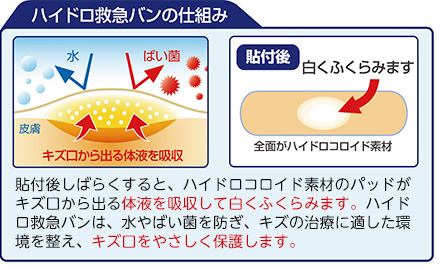 ハイドロ救急パッドの仕組み