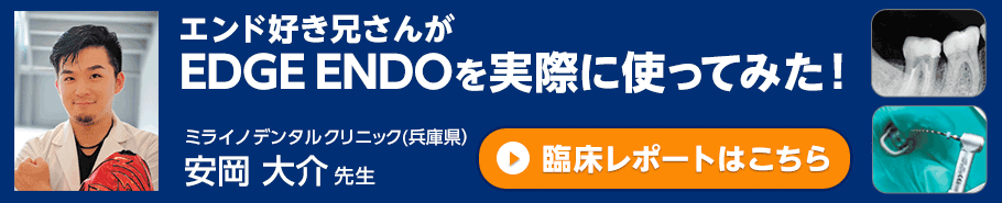EDGE ENDを実際に使ってみた！安岡大介先生