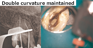 エッジシークエルサファイアを使用
