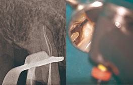 XPエンドシェイパーとエッジシークエルサファイアを使用