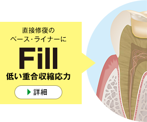 直接修復のベース・ライナーに「Fill」