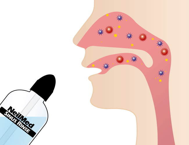 鼻腔内のウイルス・細菌・膿・花粉などを洗浄