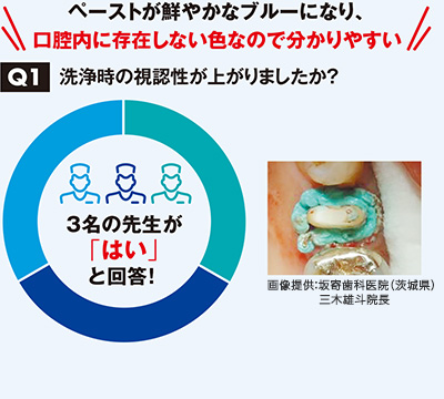 洗浄時の視認性が上がりましたか？