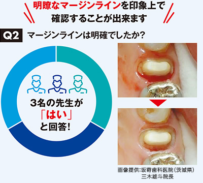 マージンラインは明確でしたか？