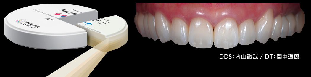 マルチ5製品画像