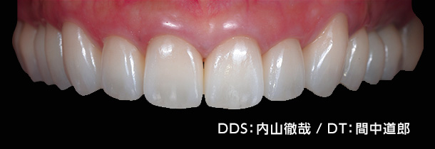 DDS：内山徹哉 / DT：間中道郎