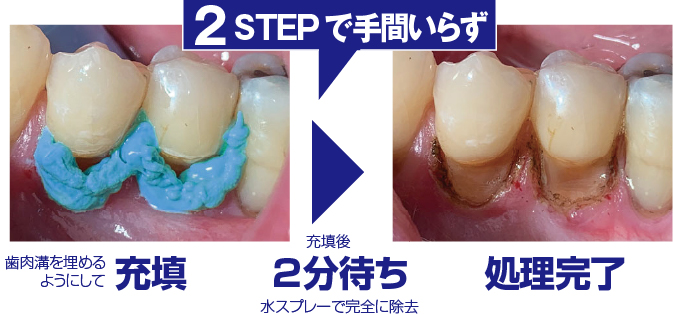 2STEPで手間いらず