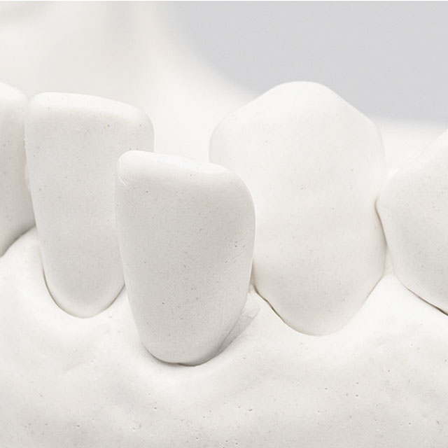 ノリタケ デンタルプラスター2 ラボ用