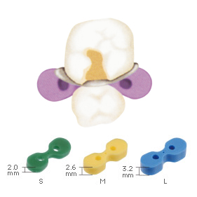 コンタクトウェッジ