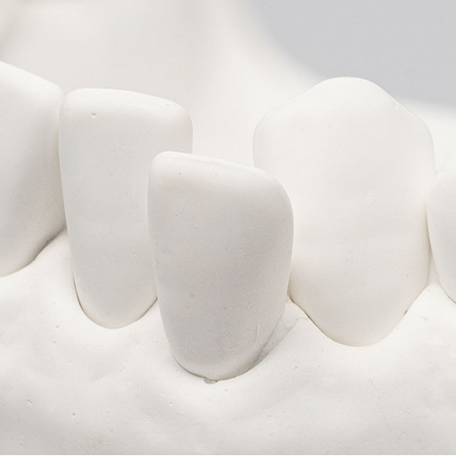 ユーデント普通石膏