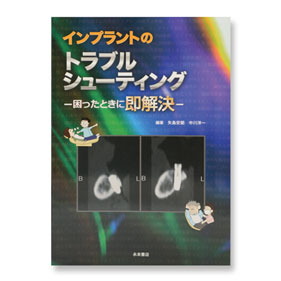 インプラントのトラブルシューティング