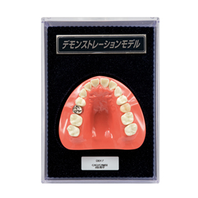 FEED デモンストレーションモデル CAD/CAM冠 対比模型