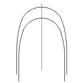 スマートクリップアーチワイヤー