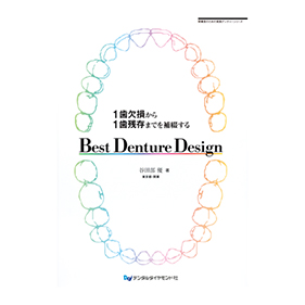 1歯欠損から1歯残存までを補綴する Best Denture Design