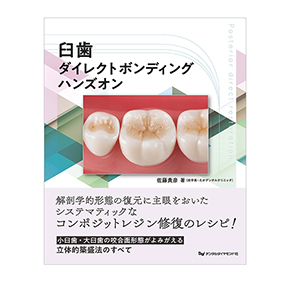 臼歯ダイレクトボンディング ハンズオン