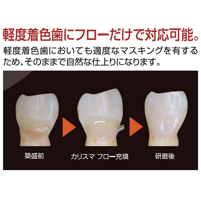 カリスマフロー　ミディアムフロー