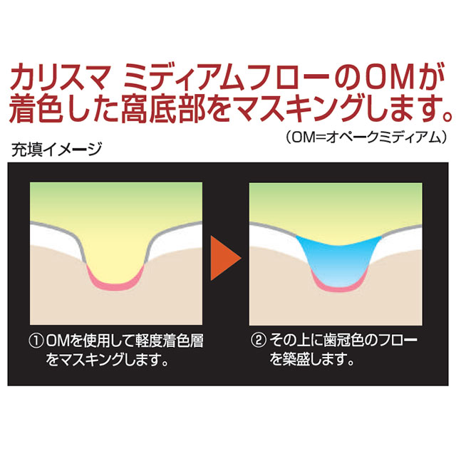 カリスマフロー　ローフロー