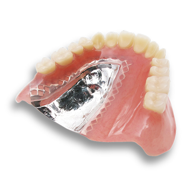 歯科サンプル　金属床義歯　模型付き　歯科医院 金属床義歯 サンプル模型