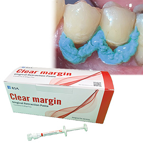 クリアマージン