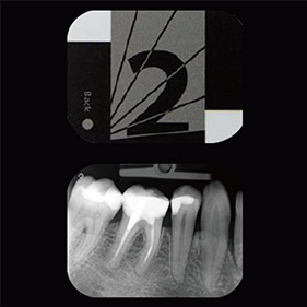 CS7200/CS7600対応 スマートプレート